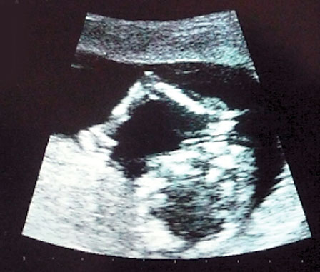 4035-154490-17babyzenga.jpg 4035-154490-17babyzenga.jpg